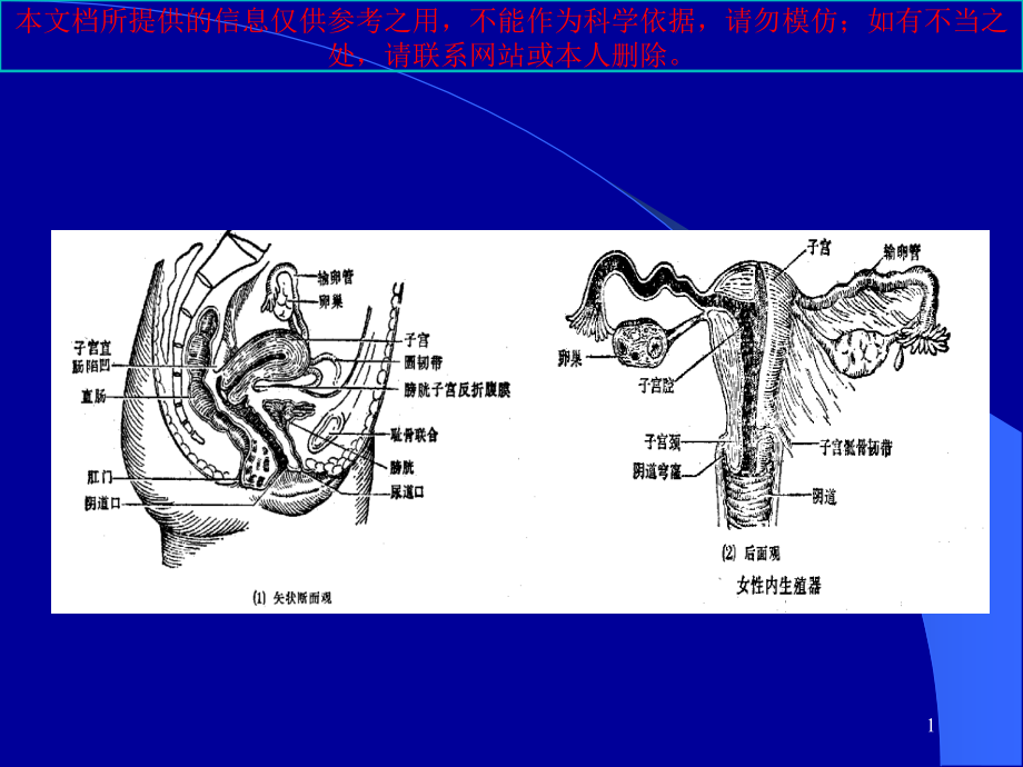 妇科肿瘤的放射治疗培训ppt课件_第1页