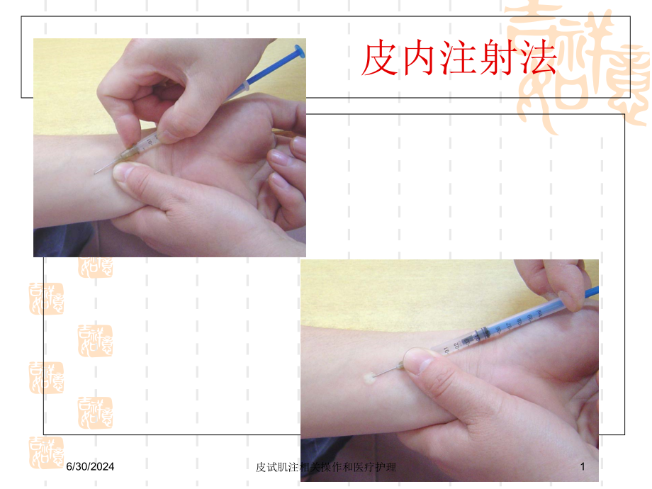 皮试肌注相关操作和医疗护理培训ppt课件_第1页