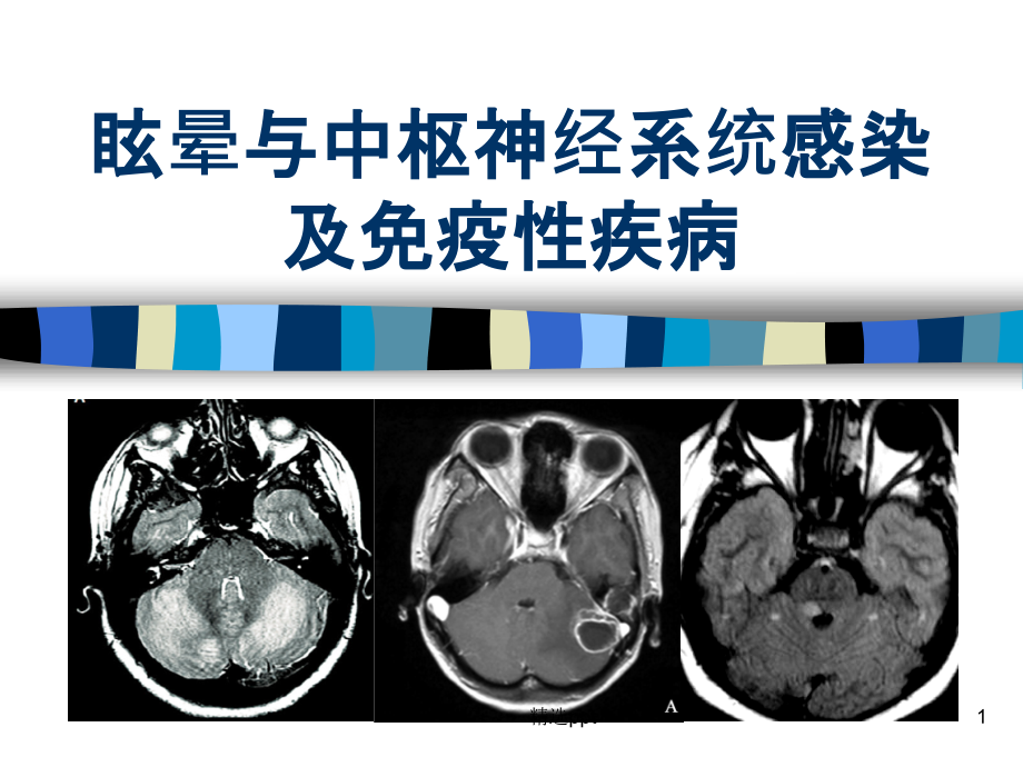 眩晕与中枢神经系统感染及免疫性疾病课件_第1页