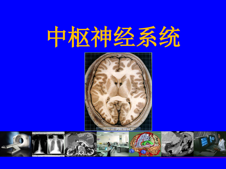 推荐医学影像诊断图文详解完整版神经系统课件_第1页