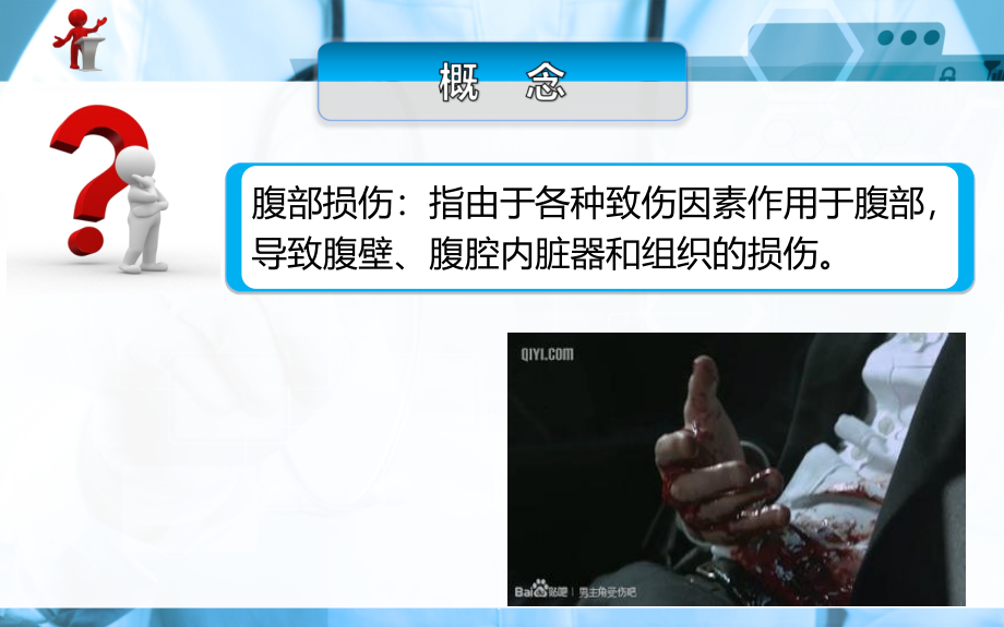 外科护理腹部损伤病人的护理ppt课件_第1页