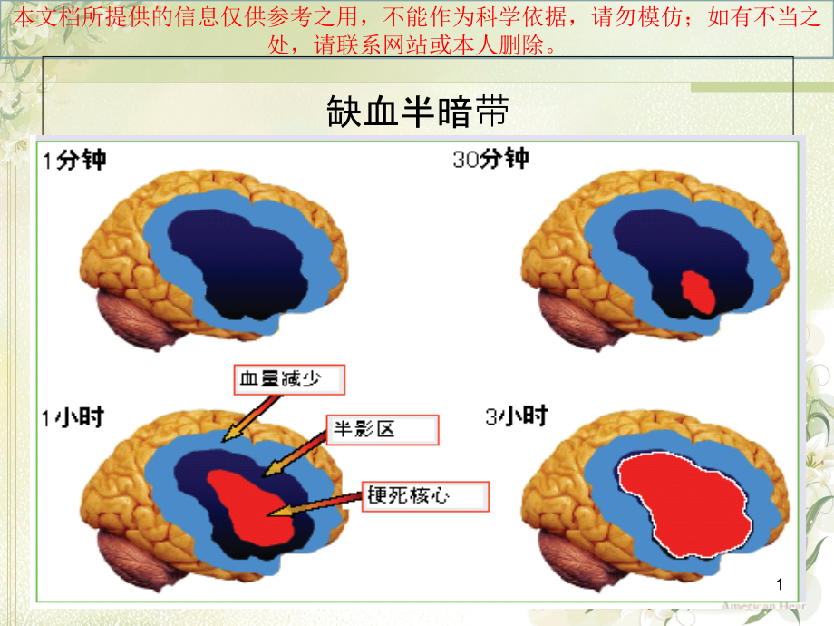 急性脑梗死静脉溶栓培训ppt课件_第1页