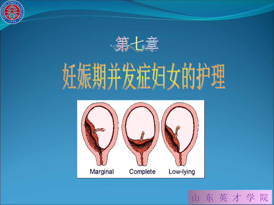 护理系《妇产科护理学》教学ppt课件_第1页