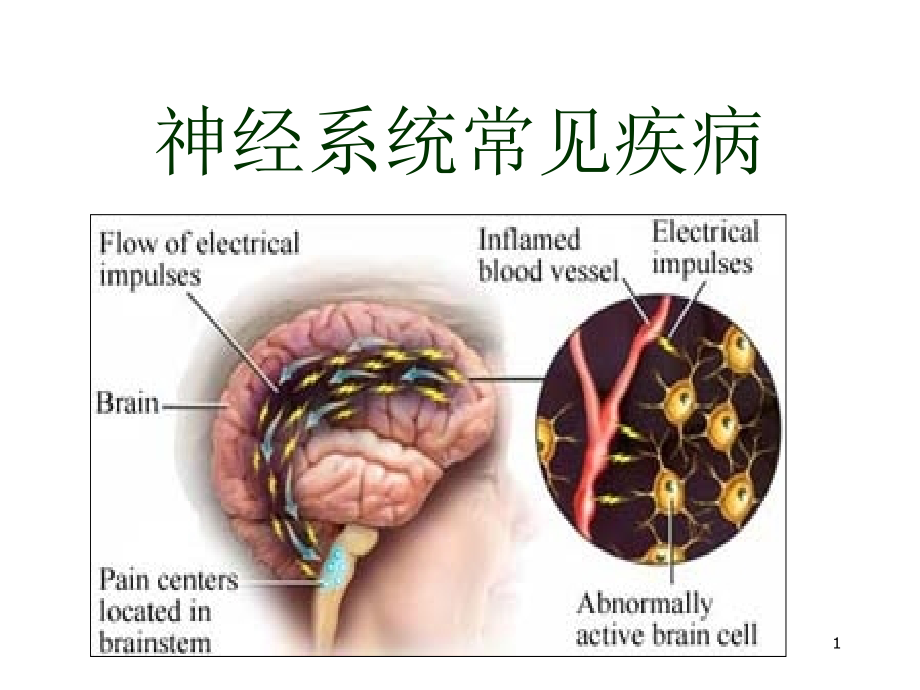 神经系统常见疾病-课件_第1页