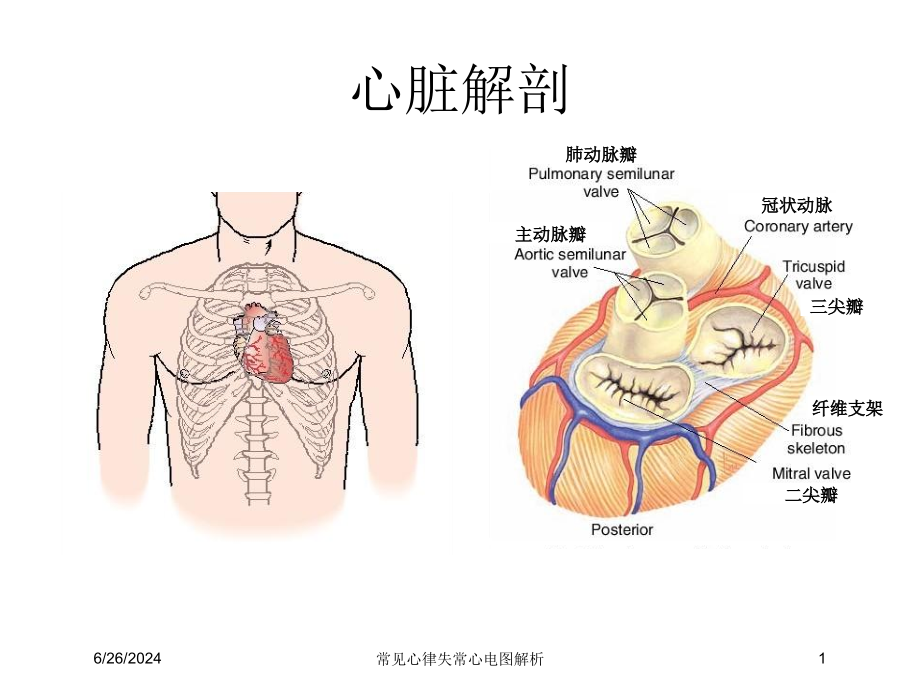 常见心律失常心电图解析ppt课件_第1页