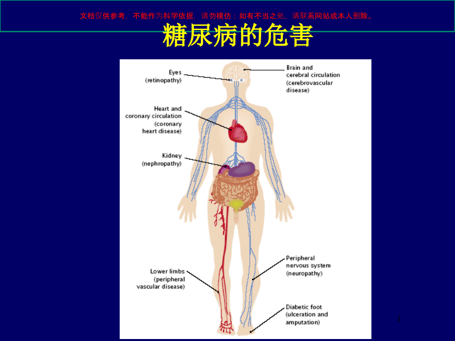 糖尿病微血管并发症DKD肾病培训ppt课件_第1页