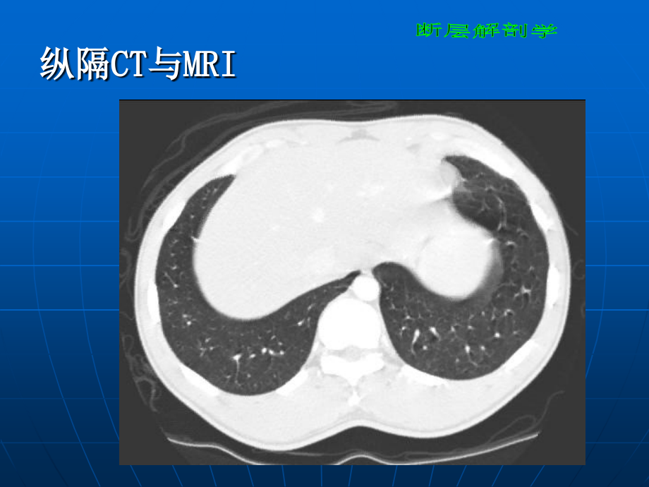 断层解剖学胸部教学课件_第1页