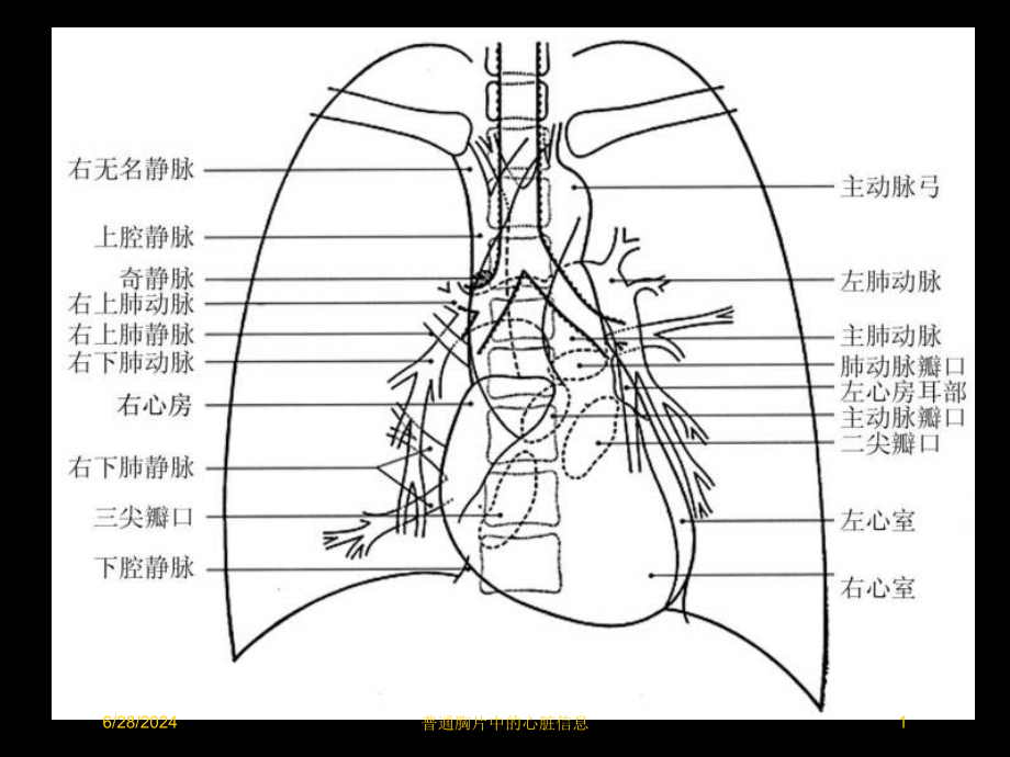 普通胸片中的心脏信息培训课件_第1页