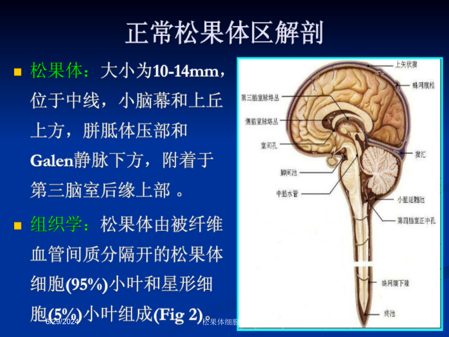 松果体细胞瘤培训ppt课件_第1页