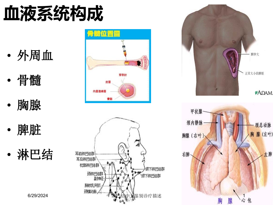 淋巴结中大鉴别诊疗描述培训ppt课件_第1页