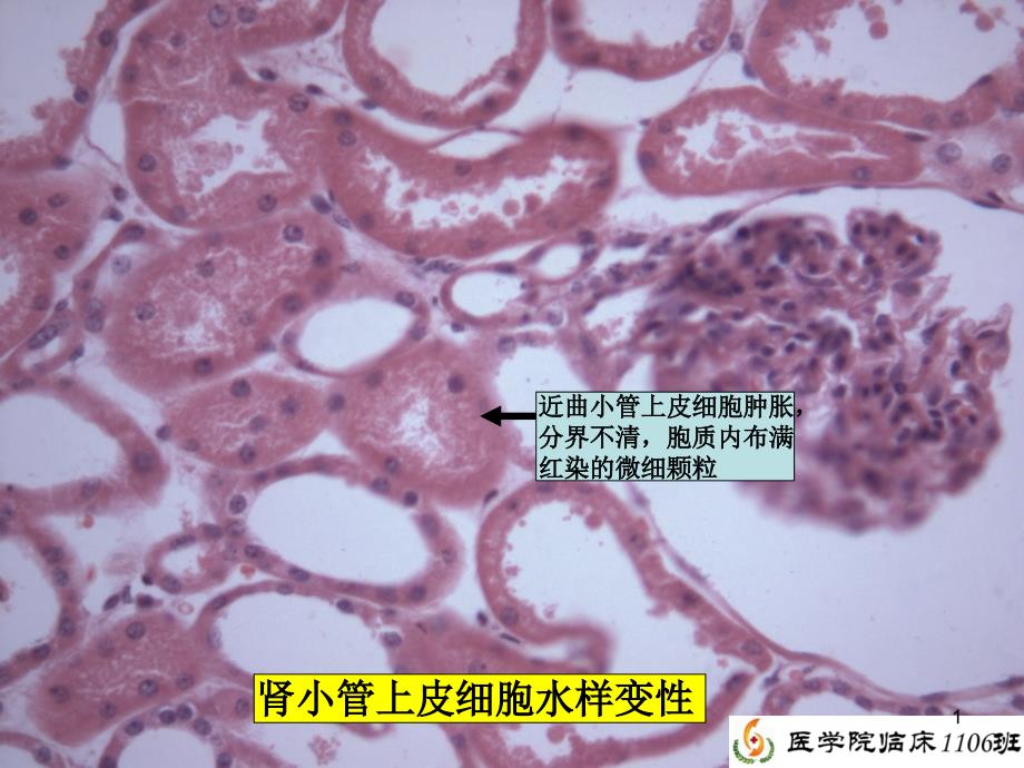 病理学实验总复习课件_第1页