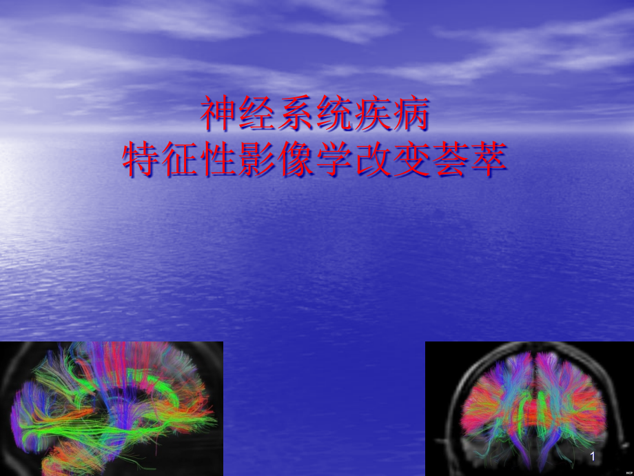 神经系统疾病的特异性影像学荟萃参考课件_第1页