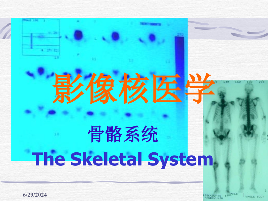 核医学骨骼系统课件_第1页