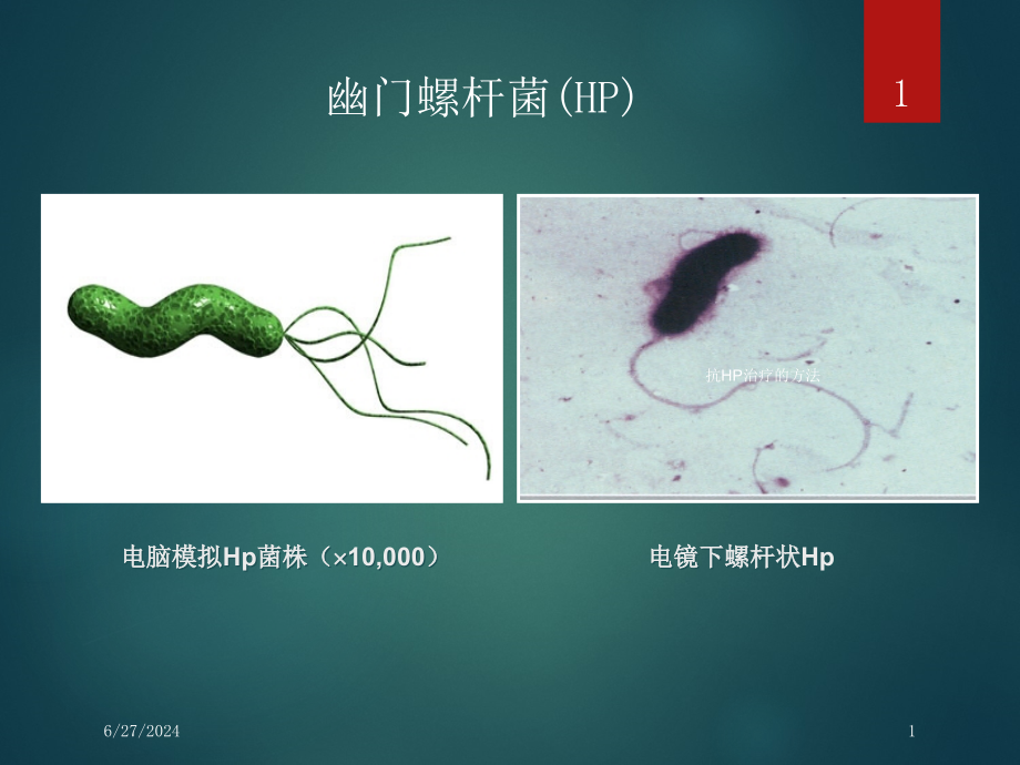 抗HP治疗的方法培训ppt课件_第1页