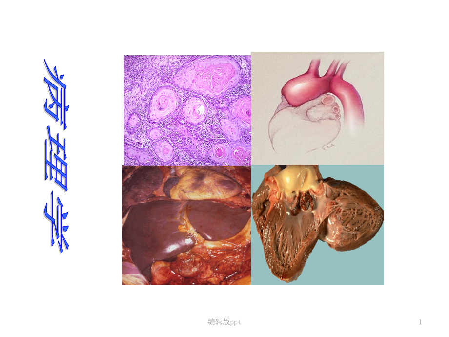 病理学ppt课件第一章绪论_第1页