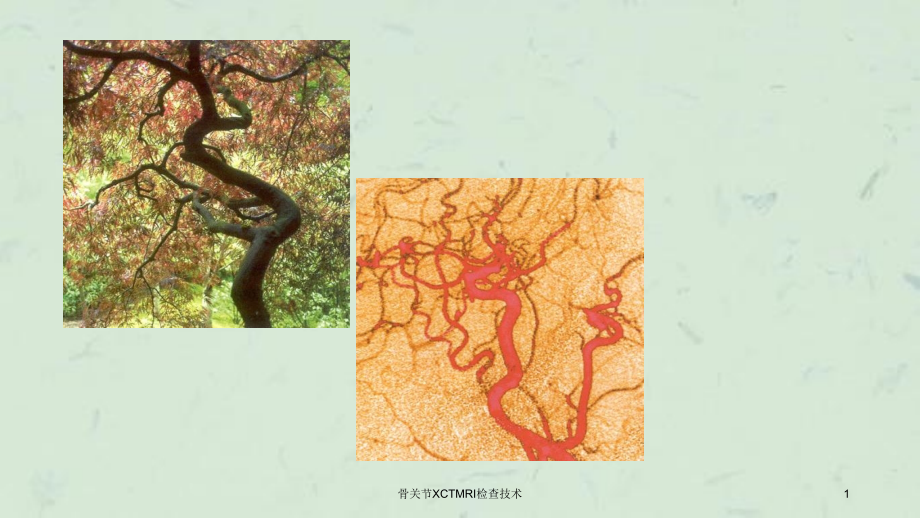 骨关节XCTMRI检查技术ppt课件_第1页