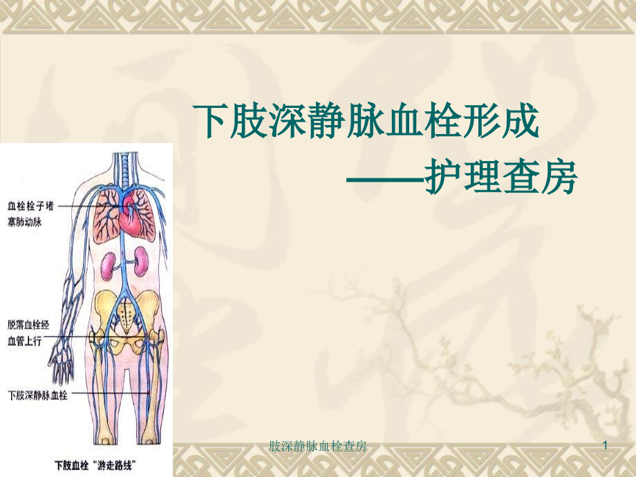 肢深静脉血栓查房ppt课件_第1页