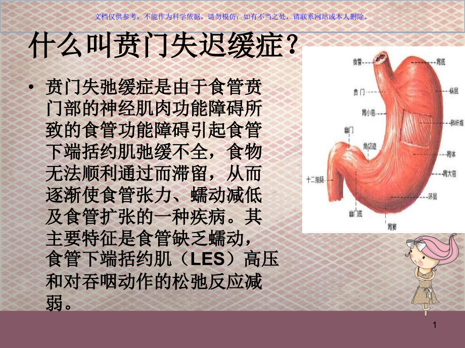 贲门失弛缓症经口内镜下肌切开术ppt课件_第1页