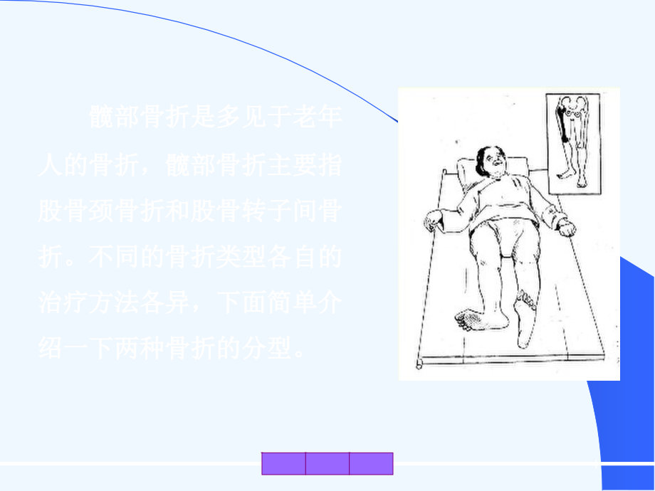 髋部骨折的分型课件_第1页