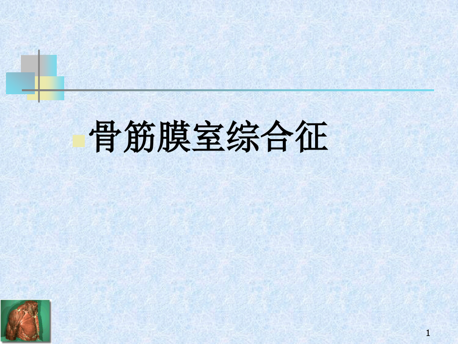 骨筋膜室综合征课件_第1页