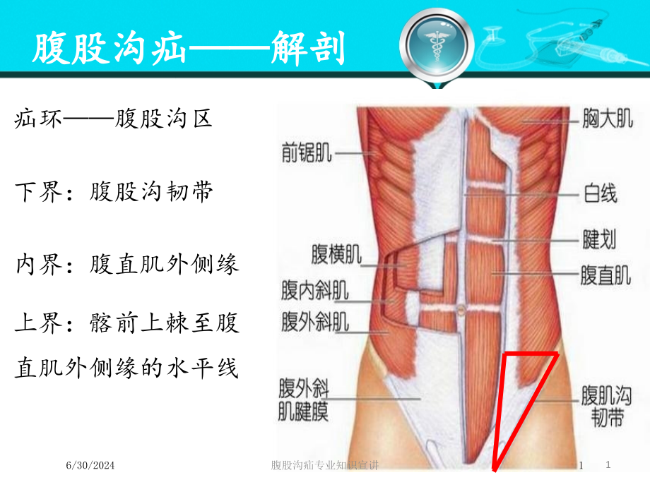 腹股沟疝专业知识宣讲培训ppt课件_第1页