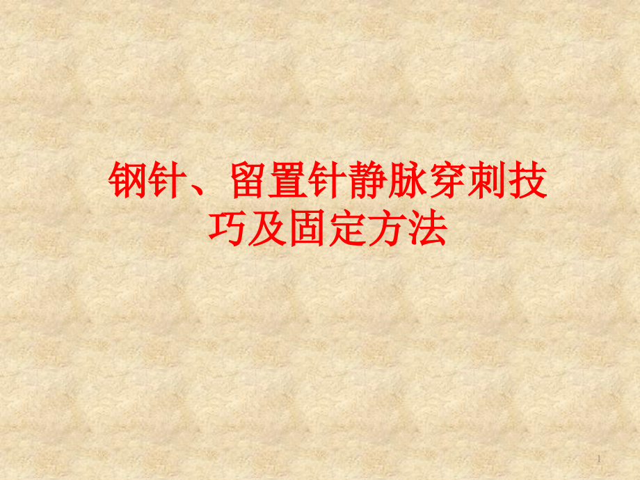 钢针留置针静脉穿刺技巧及固定方法全课件_第1页