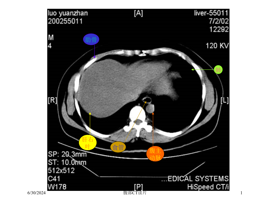 腹部CT读片培训ppt课件_第1页
