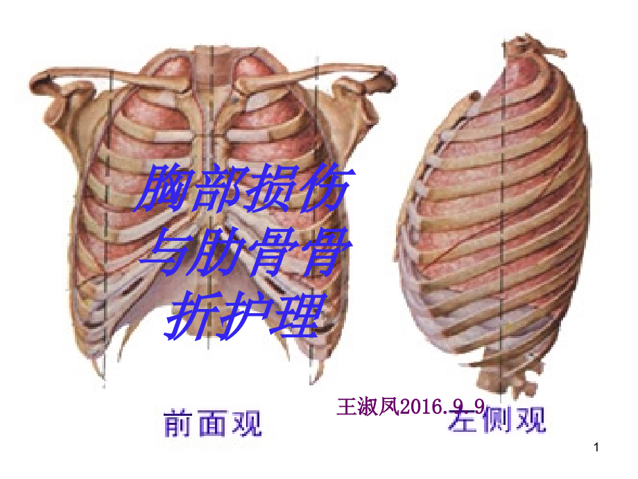 胸部损伤与肋骨骨折护理课件_第1页