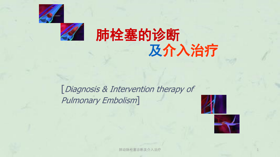 肺动脉栓塞诊断及介入治疗ppt课件_第1页