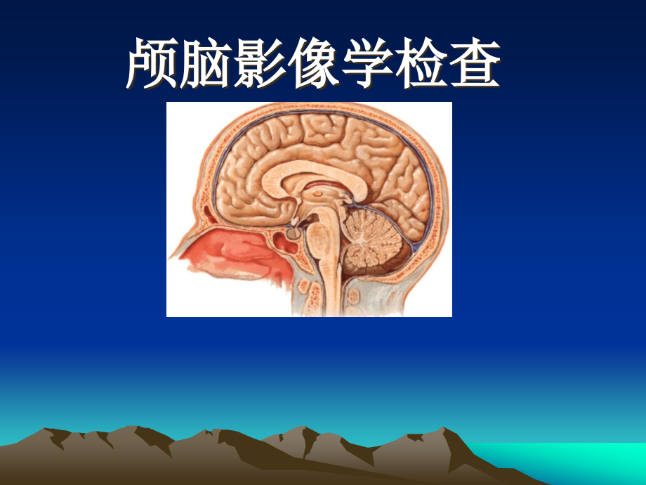 颅脑影像学检查课件_第1页