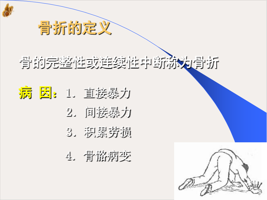 骨折一般四肢骨折护理课件_第1页