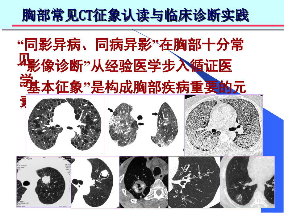 胸部和肺部CT诊疗培训ppt课件_第1页