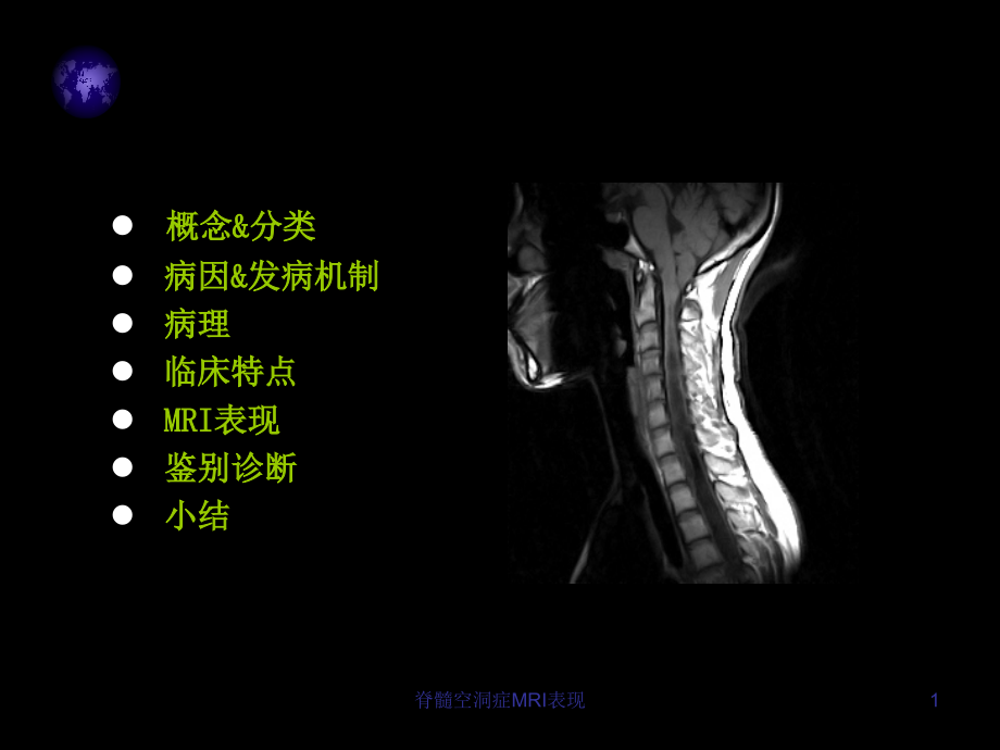 脊髓空洞症MRI表现培训ppt课件_第1页