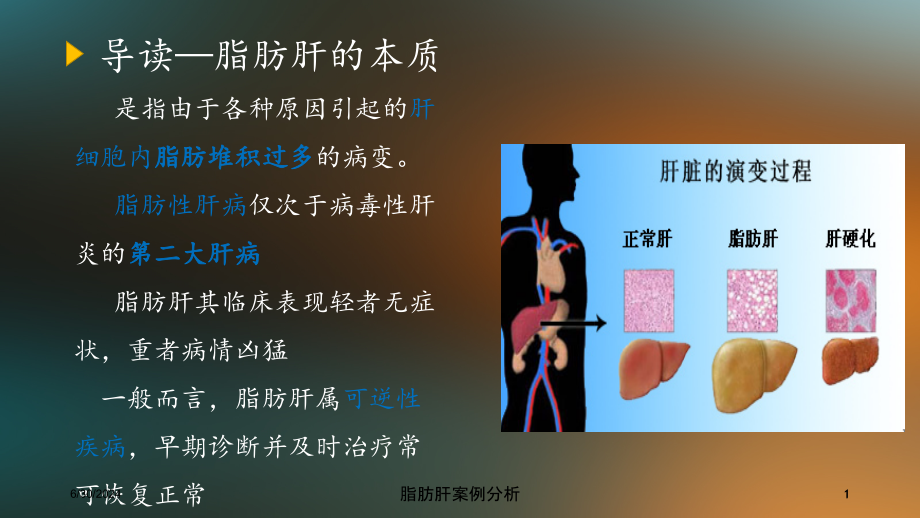 脂肪肝案例分析培训ppt课件_第1页