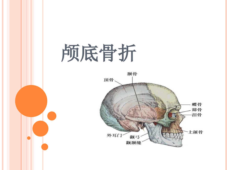 颅底骨折护理标准课件_第1页