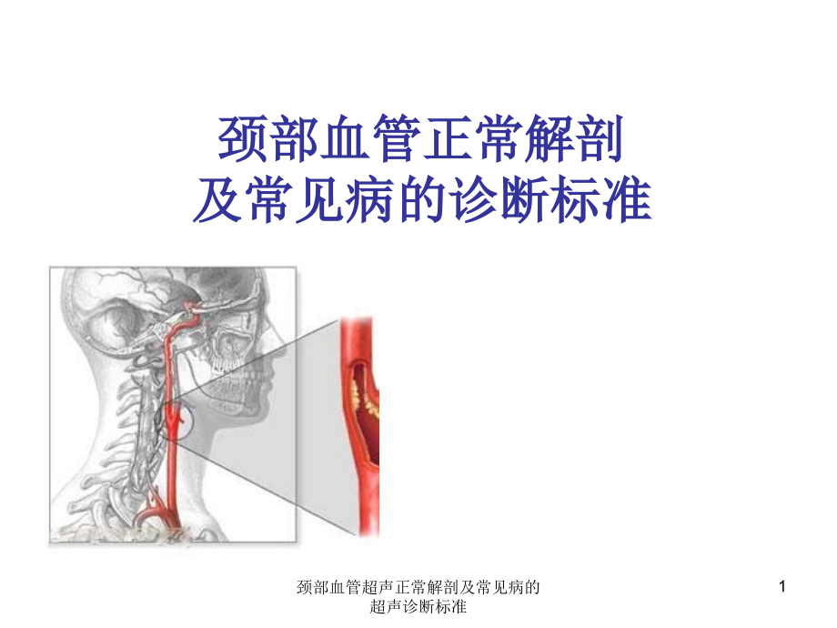 颈部血管超声正常解剖及常见病的超声诊断标准ppt课件_第1页