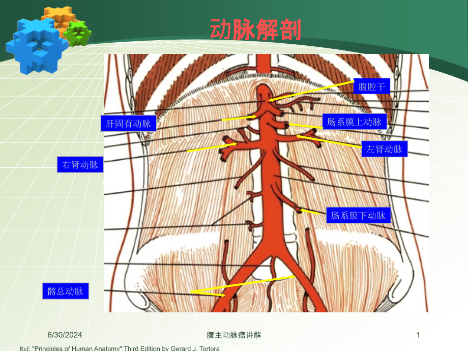 腹主动脉瘤讲解培训ppt课件_第1页