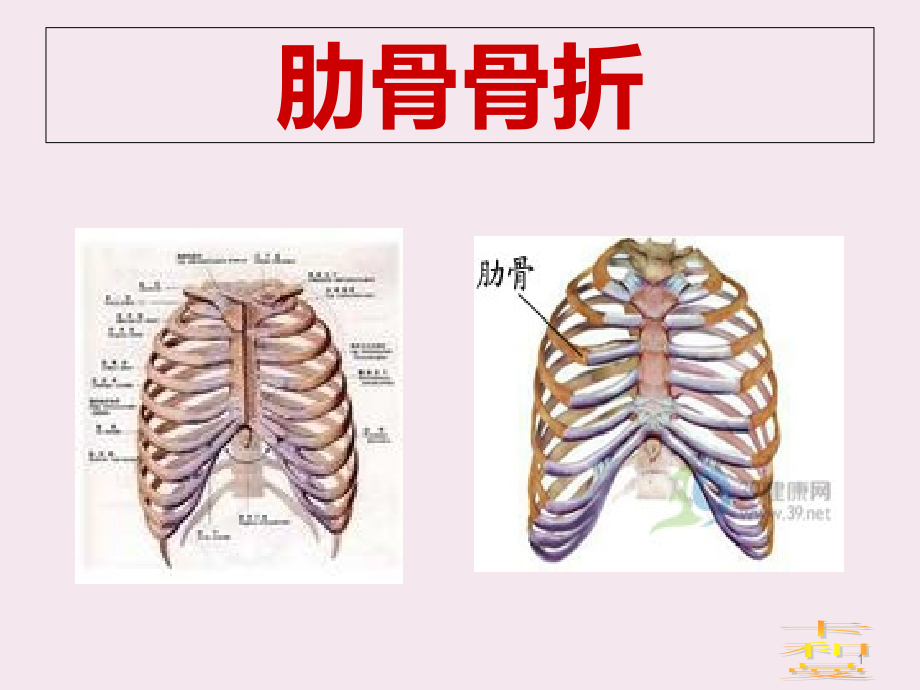 肋骨骨折与颈椎损伤(卡和曼)课件_第1页