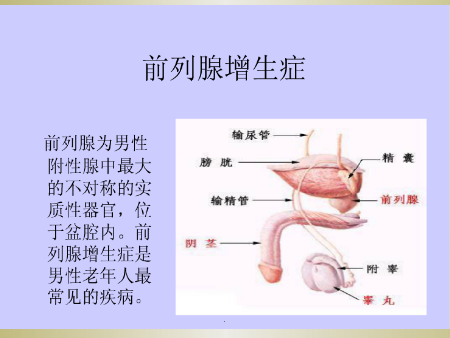 良性前列腺增生病人护理课件_第1页