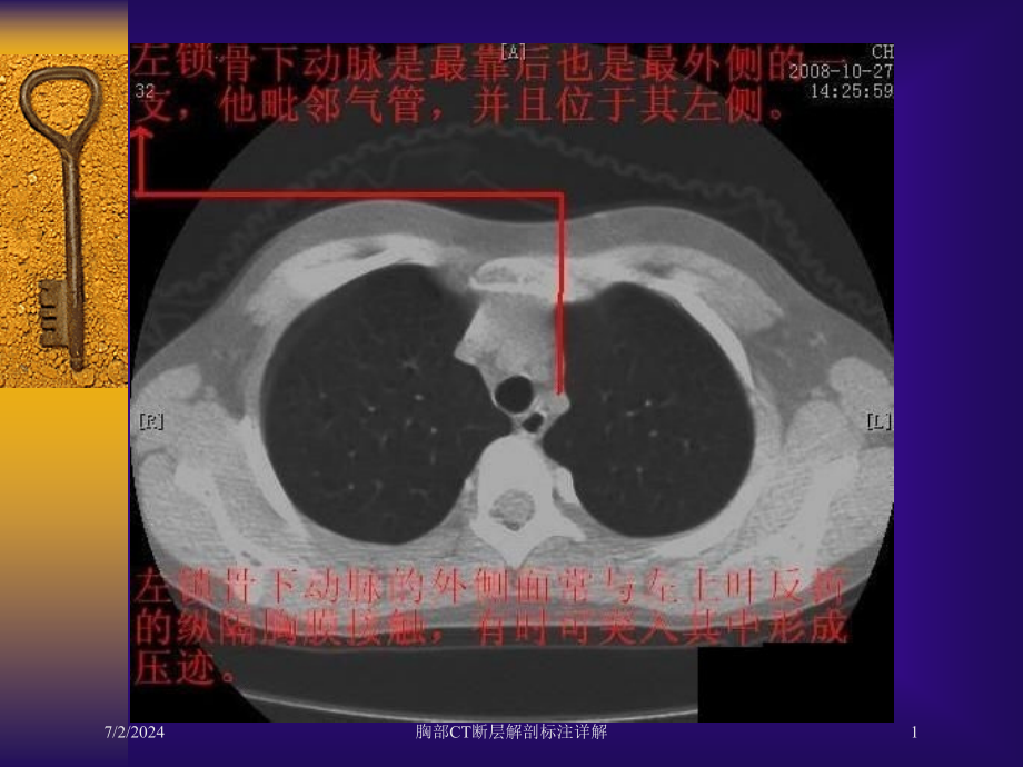 胸部CT断层解剖标注详解培训ppt课件_第1页