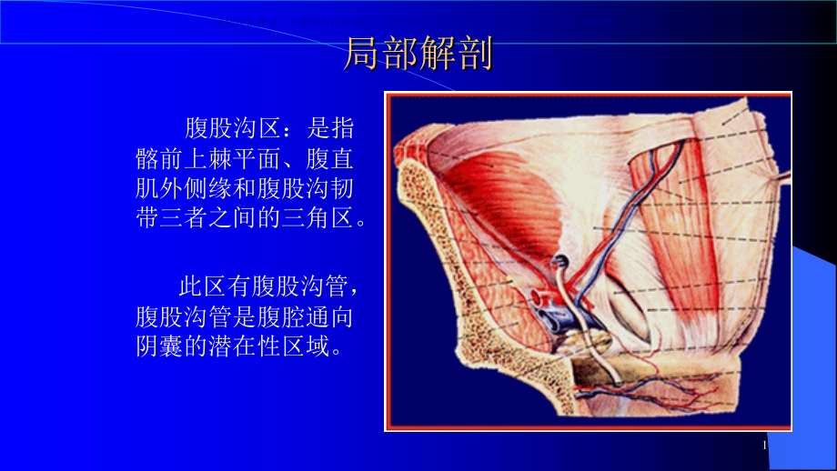 腹腔镜疝修补术医疗护理查房ppt课件_第1页