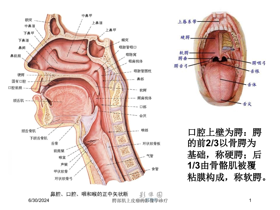 腭部肌上皮瘤的影像学诊疗培训ppt课件_第1页