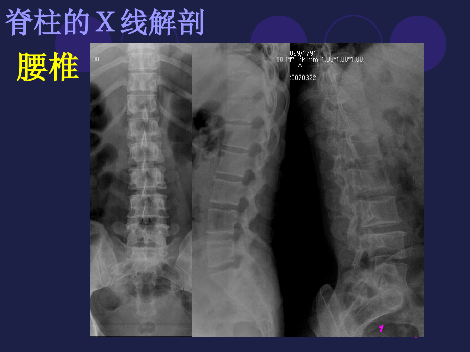 腰椎影像解剖学课件_第1页