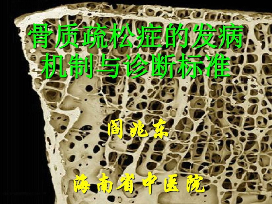 骨质疏松症实用版课件_第1页