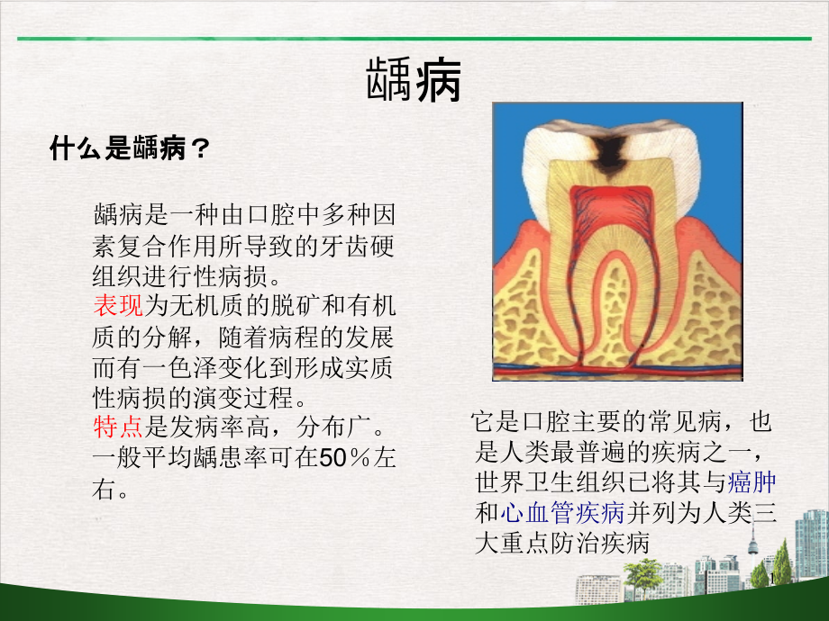 龋病的介绍窝沟封闭的应用及方法氟化泡沫防龋简介及操作方法萝岗新版课件_第1页