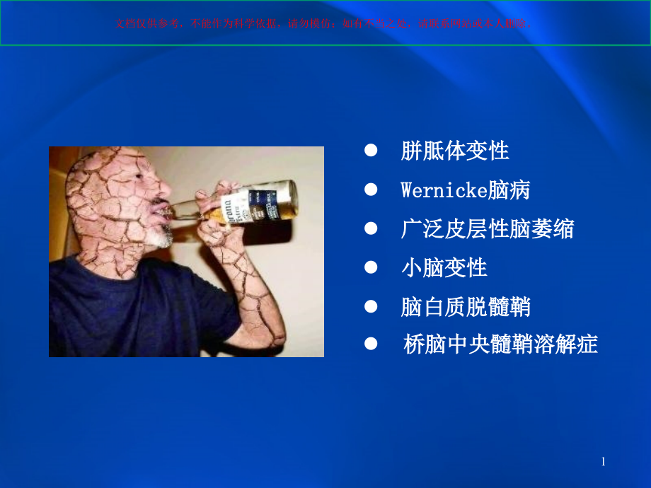 酒精中毒性脑病影像学表现ppt课件_第1页