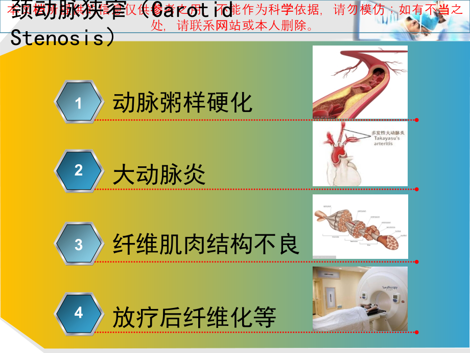 颈动脉内膜剥脱术麻醉培训ppt课件_第1页