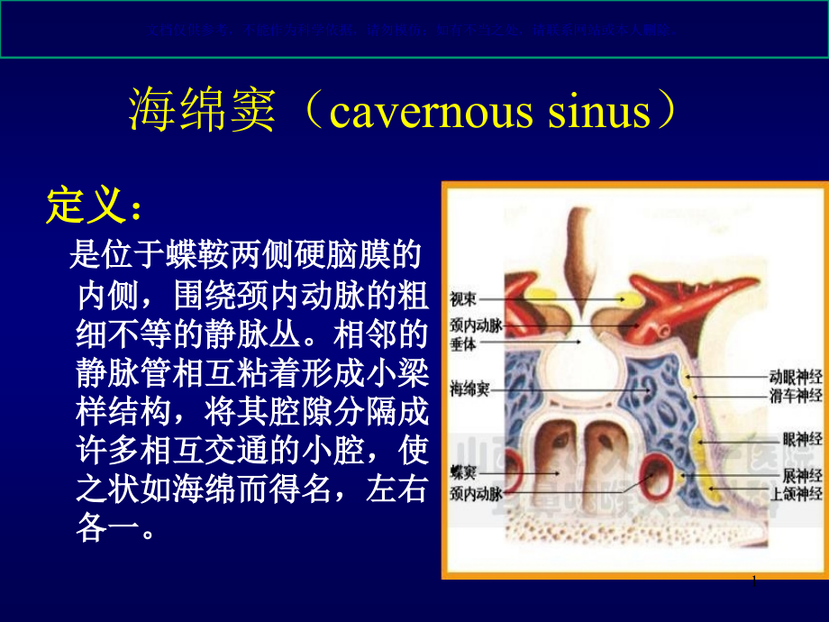颈动脉海绵窦瘘ppt课件_第1页