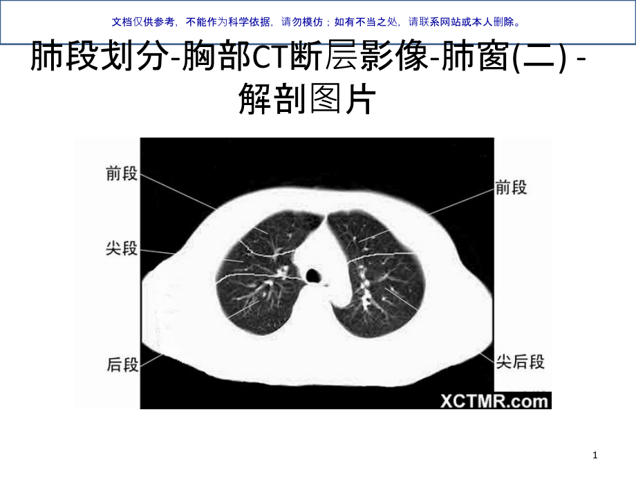 胸部CT肺段划分ppt课件_第1页