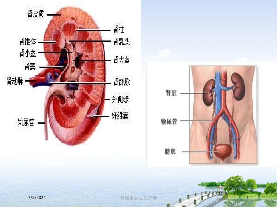 肾癌术后医疗护理培训ppt课件_第1页